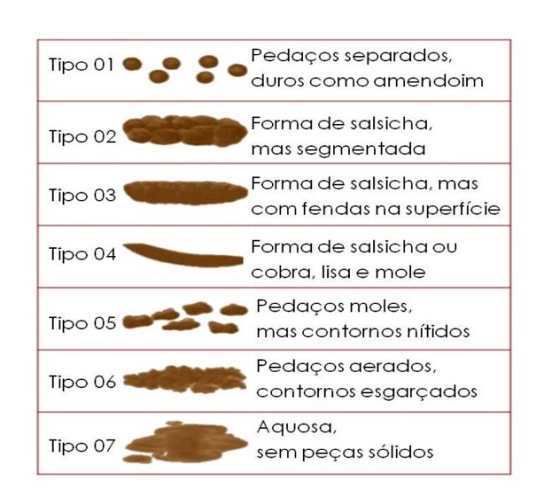 Constipação Intestinal Crônica: O que é, Causas e Tratamentos - Dra ...
