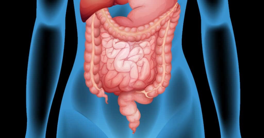 IMO - Entenda o Supercrescimento Metanogênico Intestinal que Pode Estar Causando Seus Sintomas