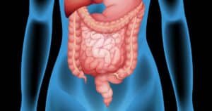 IMO - Entenda o Supercrescimento Metanogênico Intestinal que Pode Estar Causando Seus Sintomas