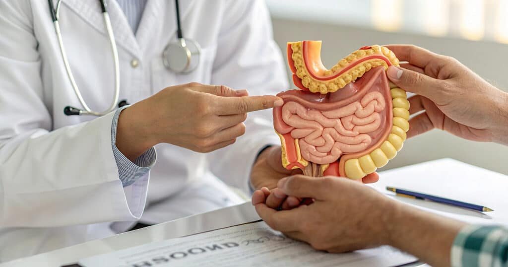 Guia Completo sobre Prevenção do Câncer Colorretal