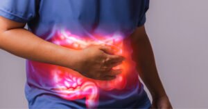 Doença de Crohn: Convivendo, Tratando e Melhorando a Qualidade de Vida